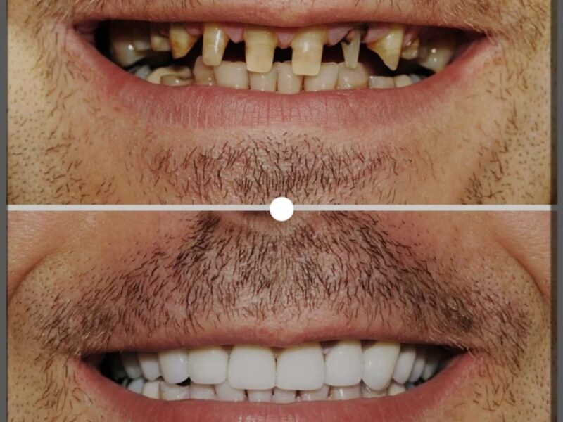 ICON Multispeciality Dental Clinic – Thamarassery