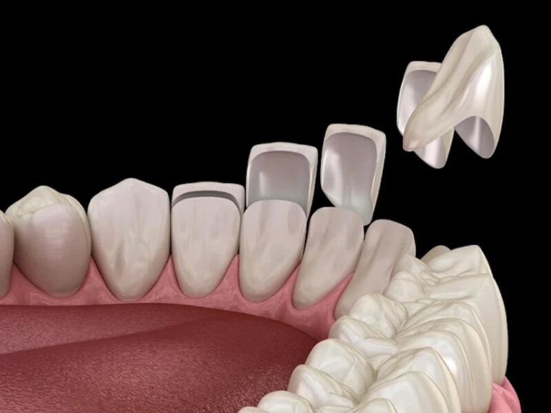 Dr. VMR’s ORBIT DENTAL CARE – Thamarassery