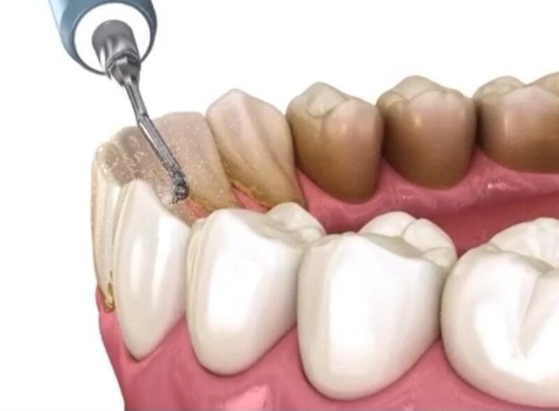 Dr. VMR’s ORBIT DENTAL CARE – Thamarassery