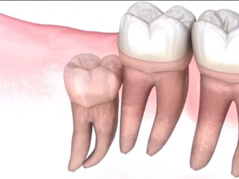 Dr. VMR’s ORBIT DENTAL CARE – Thamarassery