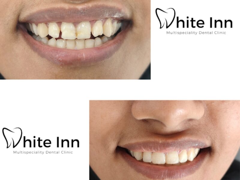 White Inn Multispeciality Dental Clinic