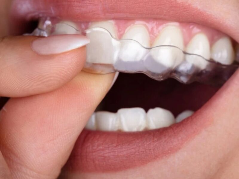 Xpert Dental Clinic, Puthoorvattom