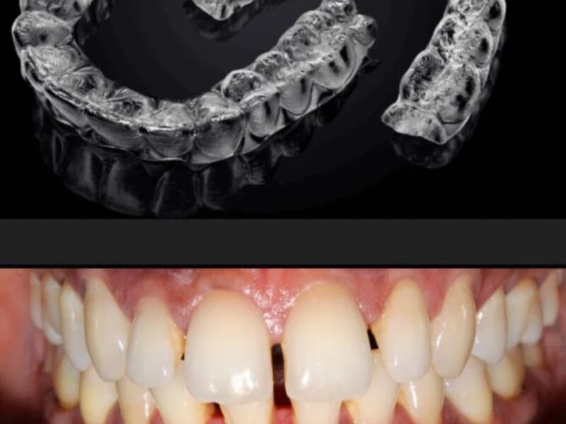 Xpert Dental Clinic, Puthoorvattom