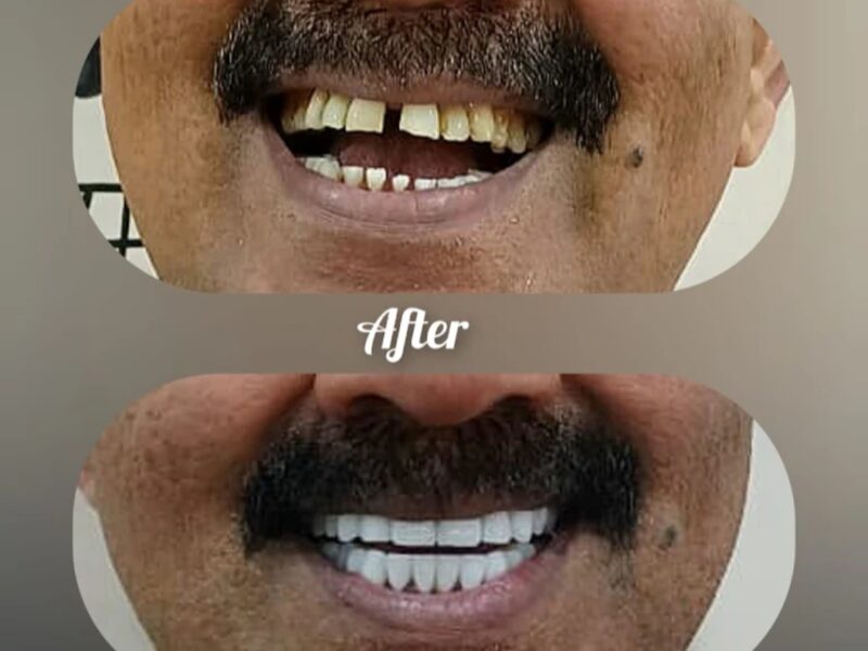 Xpert Dental Clinic, Puthoorvattom