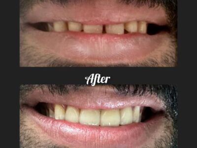 Xpert Dental Clinic, Puthoorvattom