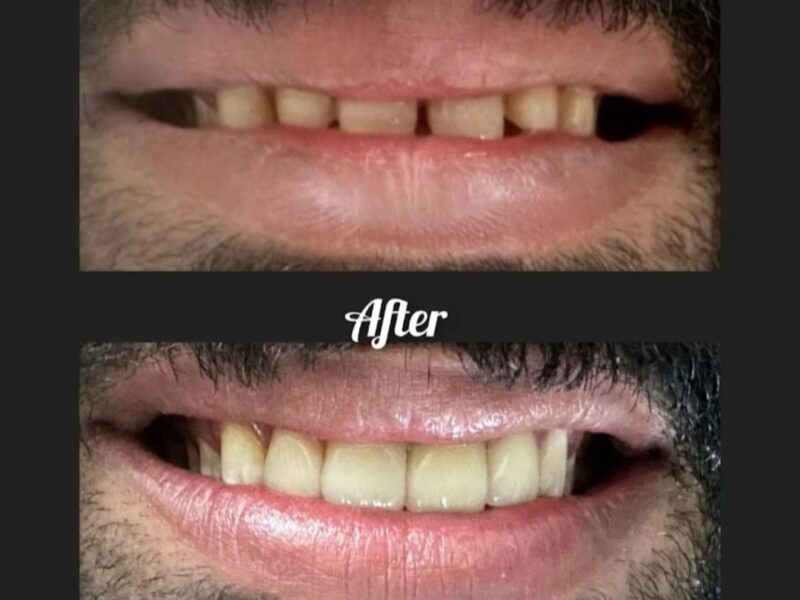 Xpert Dental Clinic, Puthoorvattom