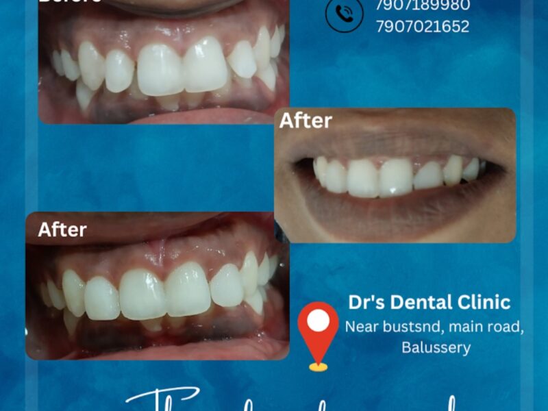 Drs Dental Clinic – Balussery