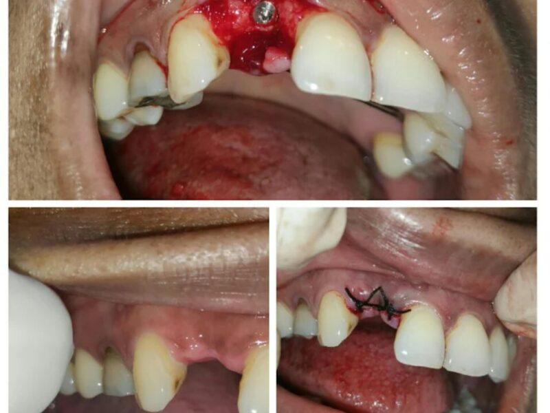 MIDENT Multispeciality Dental and Implant Clinic