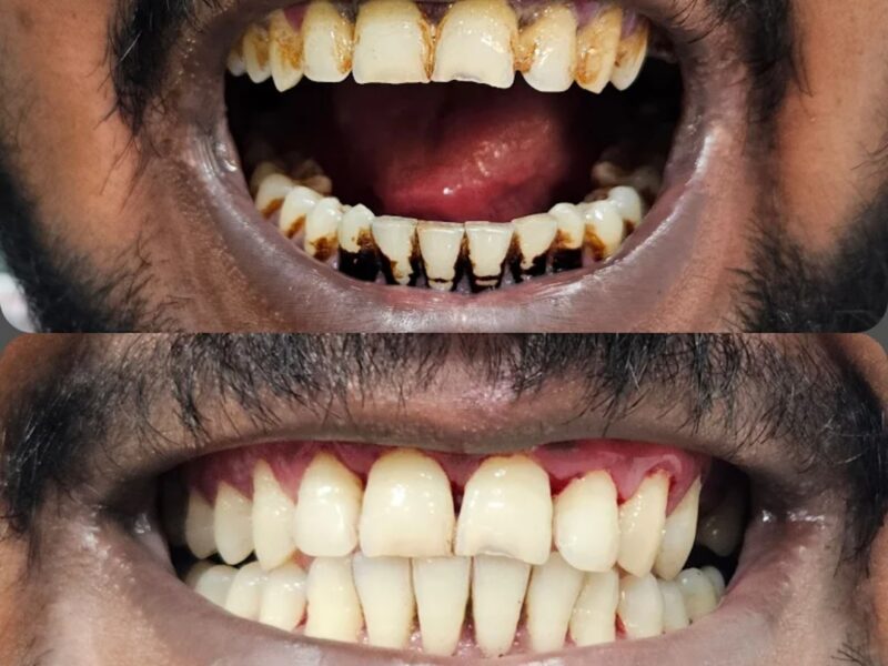 Dr. Khans Smile Denta Care Koduvally